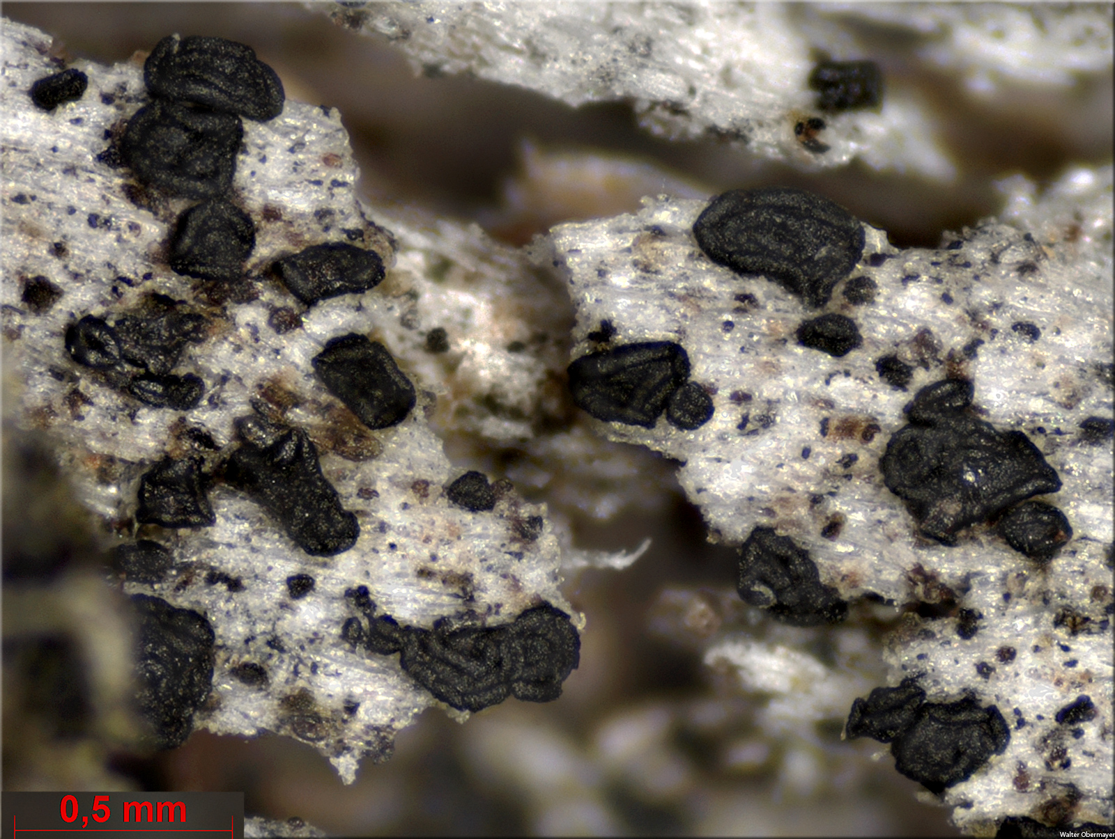 elixiaflexellaobermayer